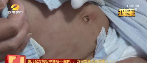 孩子全身突然起大片大片的红:孩子全身突然起大片红疹?警惕这些原因并及时应对! 孩子全身突然起大片大片的红:孩子全身突然起大片红疹?警惕这些原因并及时应对!