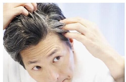 头顶头发稀少怎么补救:头顶头发稀少怎么补救?这些方法帮你重拾浓密秀发! 头顶头发稀少怎么补救:头顶头发稀少怎么补救?这些方法帮你重拾浓密秀发!