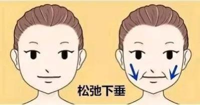 脸部脂肪多怎么瘦:告别圆脸!科学减脂,有效减少脸部脂肪 脸部脂肪多怎么瘦:告别圆脸!科学减脂,有效减少脸部脂肪