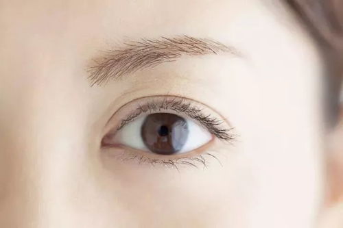 眼皮浮肿是什么原因引起的:眼皮浮肿是什么原因引起的?这些原因你可能不知道! 眼皮浮肿是什么原因引起的:眼皮浮肿是什么原因引起的?这些原因你可能不知道!