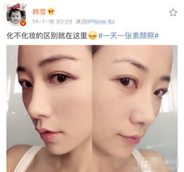 鼻翼缩小术千万别做:鼻翼缩小术,你真的需要做吗? 鼻翼缩小术千万别做:鼻翼缩小术,你真的需要做吗?