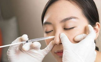 鼻翼缩小术千万别做:鼻翼缩小术,你真的需要做吗? 鼻翼缩小术千万别做:鼻翼缩小术,你真的需要做吗?