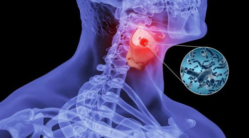 慢性咽炎在喉咙打一针：慢性咽炎在喉咙打一针？这种神奇疗法能帮你告别喉咙不适！