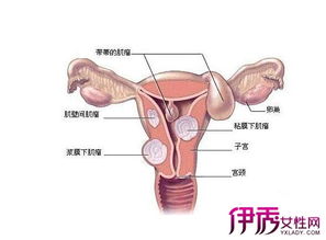 宫颈糜烂的症状有哪些:女性必看,宫颈糜烂的常见症状及应对措施 宫颈糜烂的症状有哪些:女性必看,宫颈糜烂的常见症状及应对措施