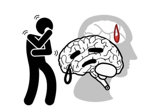 脑中风的前兆是什么:警惕身体发出的求救信号,脑中风前兆识别指南(附黄金救治时间窗) 脑中风的前兆是什么:警惕身体发出的求救信号,脑中风前兆识别指南(附黄金救治时间窗)