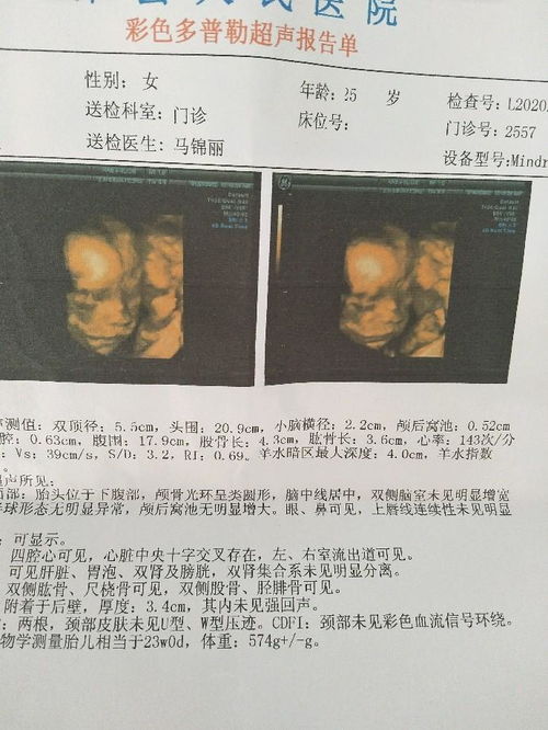 四维三个数据看男女:四维/三维数据看男女?准爸妈必读的科学解读指南 四维三个数据看男女:四维/三维数据看男女?准爸妈必读的科学解读指南